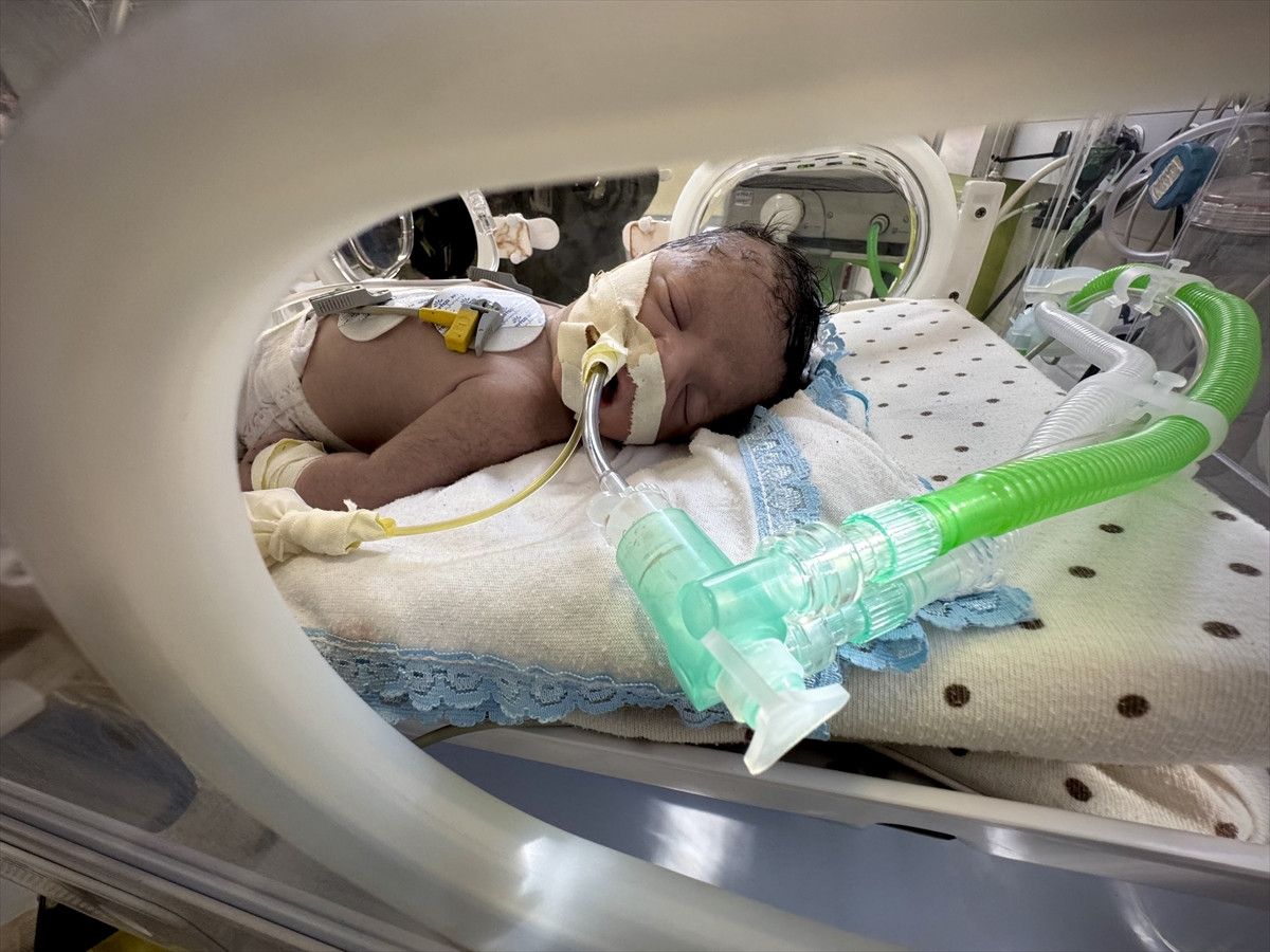 israil saldirisinda olen filistinli kadinin karnindaki bebek kurtarildi 1