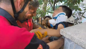 sanliurfada korkutan kaza demir korkuluk cocugun koluna saplandi Lz53wQlI