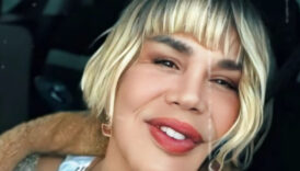 sezen aksunun son hali yeni imajina yorum yagdi 1ain32WQ