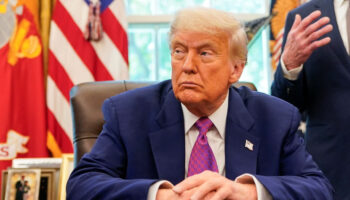 trumpa kronik venoz yetmezlik teshisi konuldu fF9Tf6G4