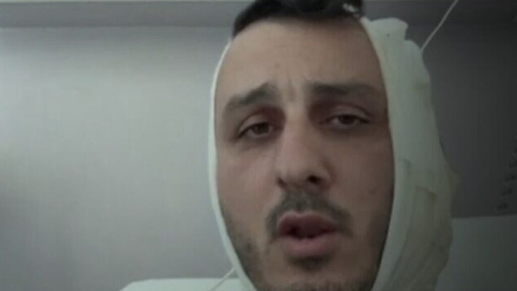 yunanistana tatile giden israilliye saldiri kulagini kopardi e7lyu7MB