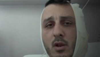 yunanistana tatile giden israilliye saldiri kulagini kopardi e7lyu7MB