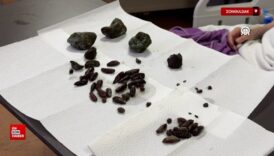 zonguldakta kadin yuttugu zeytin ve hurma cekirdekleri nedeniyle ameliyat edildi QKyEzrH1