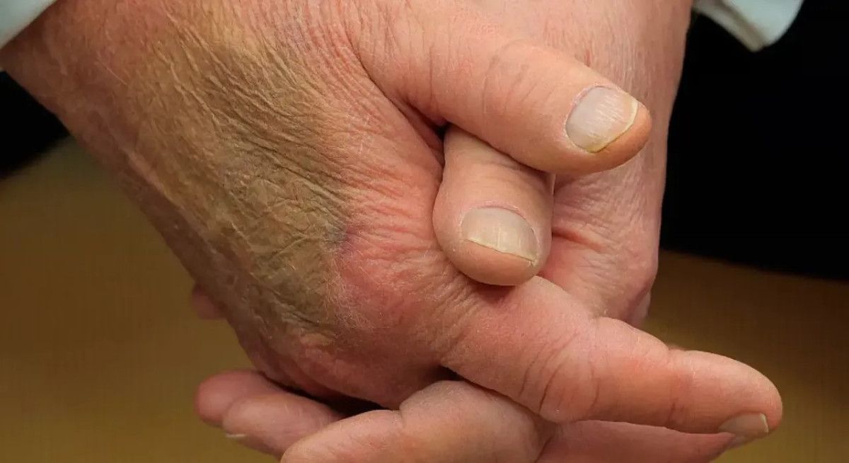 donald trumpin eli neden morardi iste sebebi 2