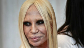 estetik kurbani olmustu iste versacenin son hali 5xTBzUZt