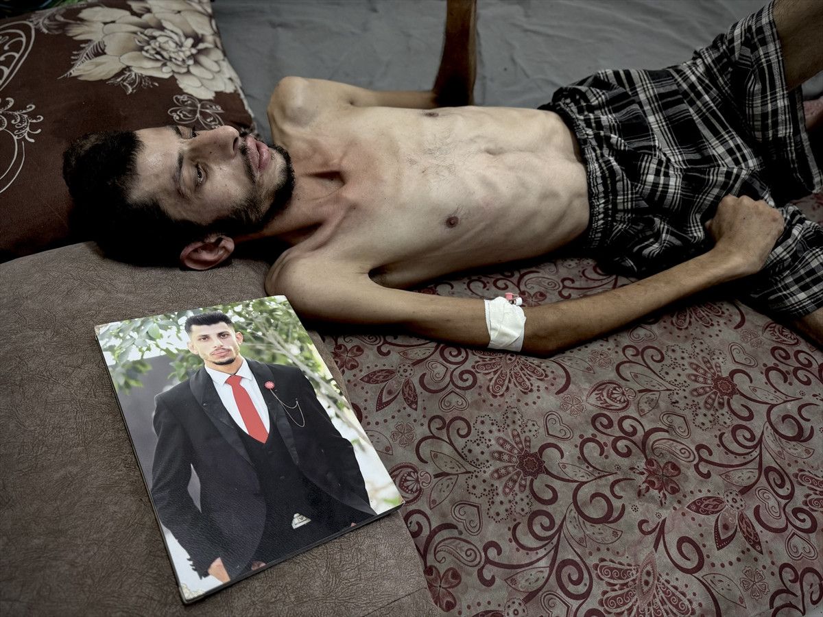 Gazze'de 11 kişi daha açlıktan hayatını kaybetti 1 gazzede 11 kisi daha acliktan hayatini kaybetti 0