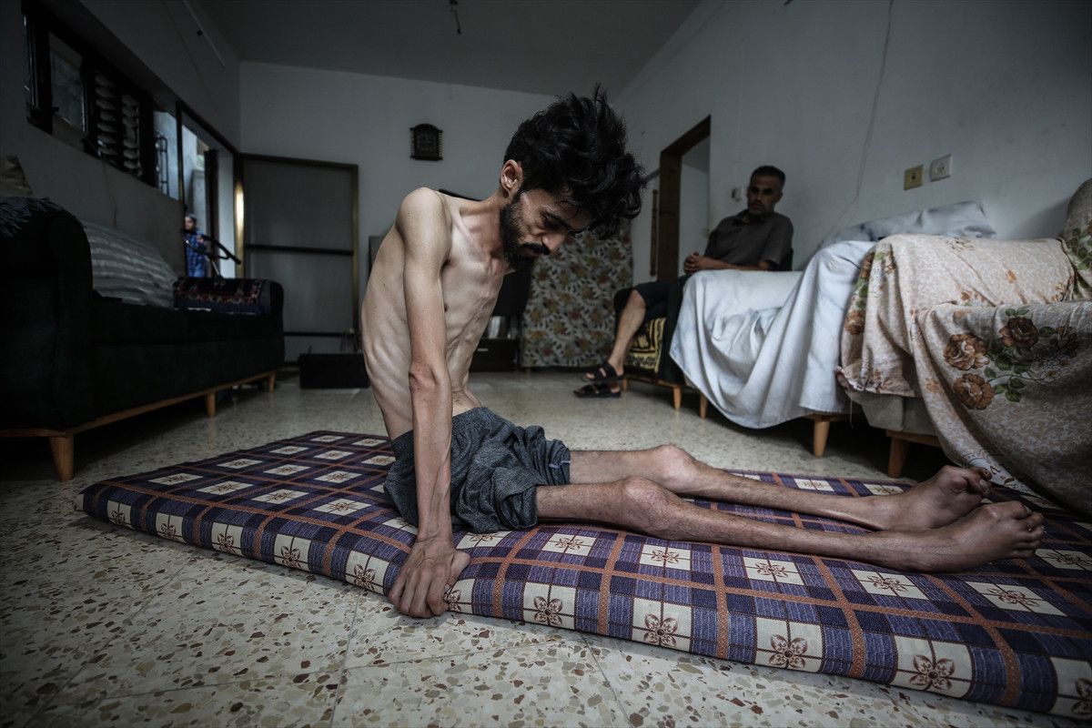 Gazze'de 11 kişi daha açlıktan hayatını kaybetti 5 gazzede 11 kisi daha acliktan hayatini kaybetti 4 KUAsdD3v