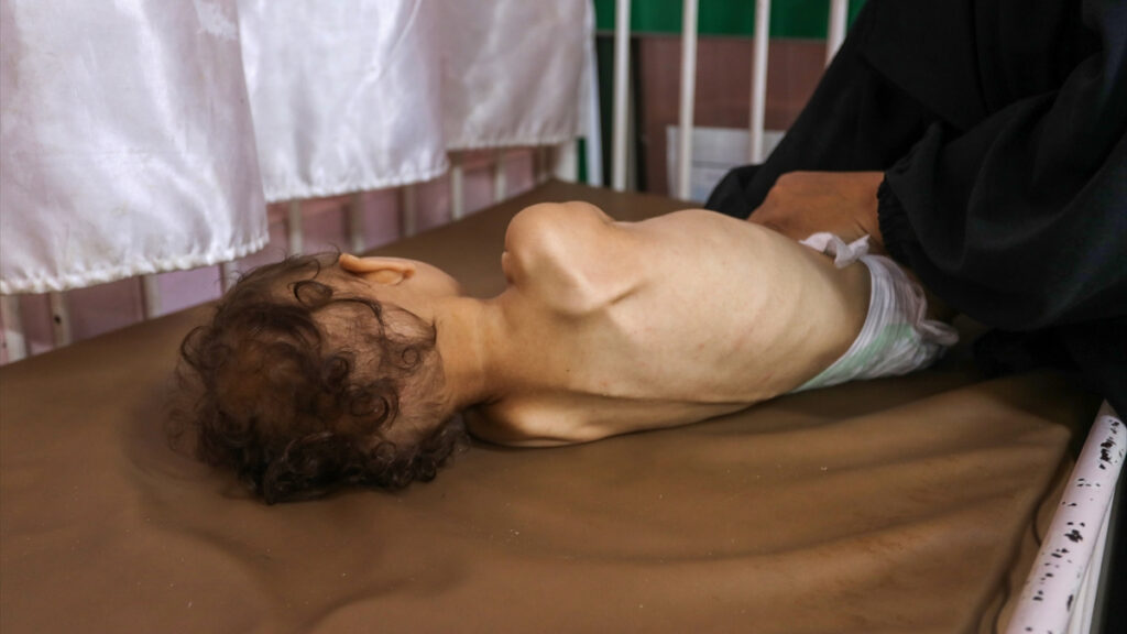 gazzede 11 kisi daha acliktan hayatini kaybetti v7D52mvi