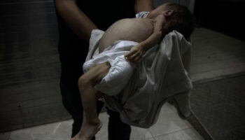 gazzede 2 aylik rasil bebek aclik sebebiyle hayatini kaybetti CA6jIXKc