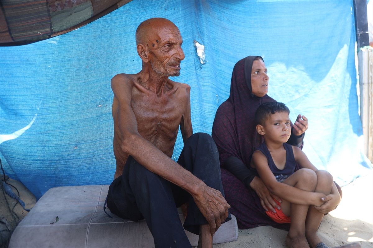 Gazze'de açlıktan ölenlerin sayısı artıyor 3 gazzede acliktan olenlerin sayisi artiyor 2 Qhn4cBK5