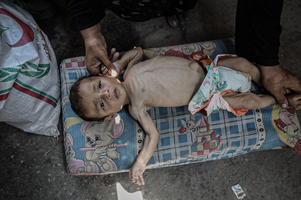 Gazze'de açlıktan ölenlerin sayısı artıyor 4 gazzede acliktan olenlerin sayisi artiyor 3 T4BG6qlb