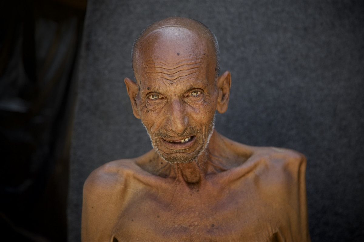 Gazze'de açlıktan ölenlerin sayısı artıyor 5 gazzede acliktan olenlerin sayisi artiyor 4 5lKTtVCm