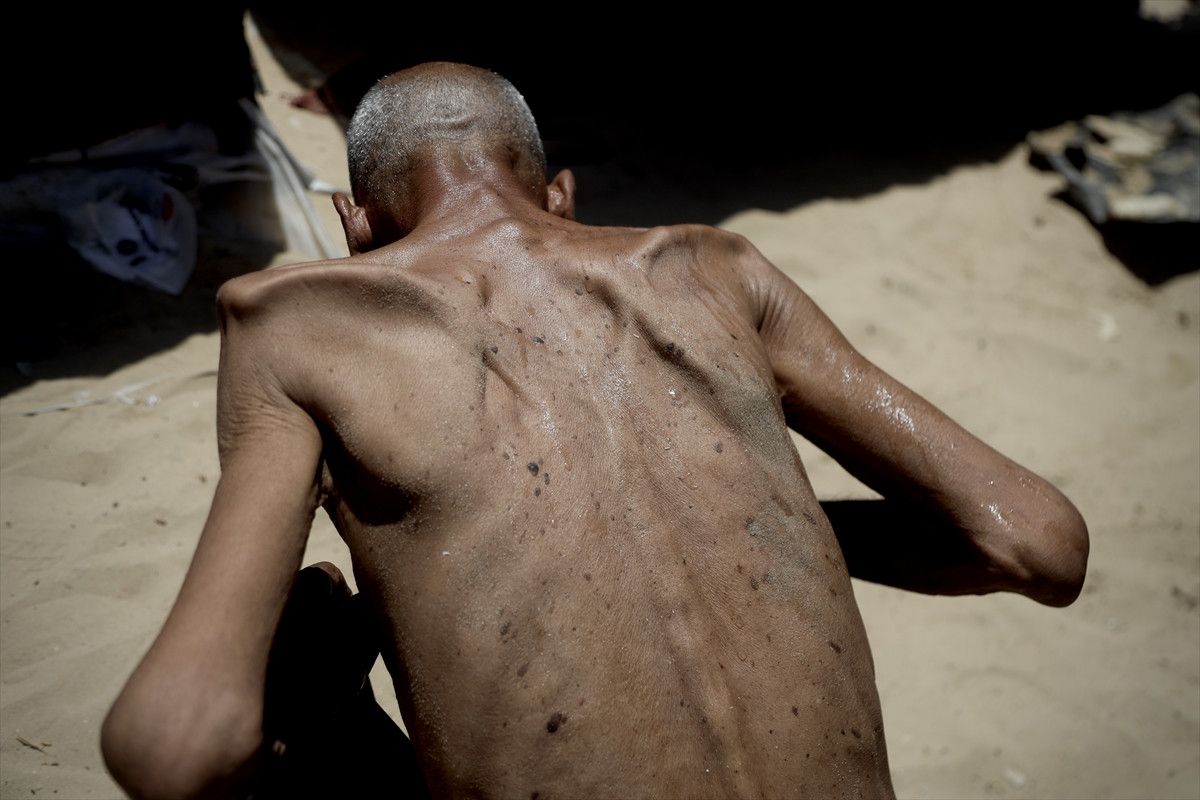 Gazze'de açlıktan ölenlerin sayısı artıyor 7 gazzede acliktan olenlerin sayisi artiyor 6 ghuzTmlV