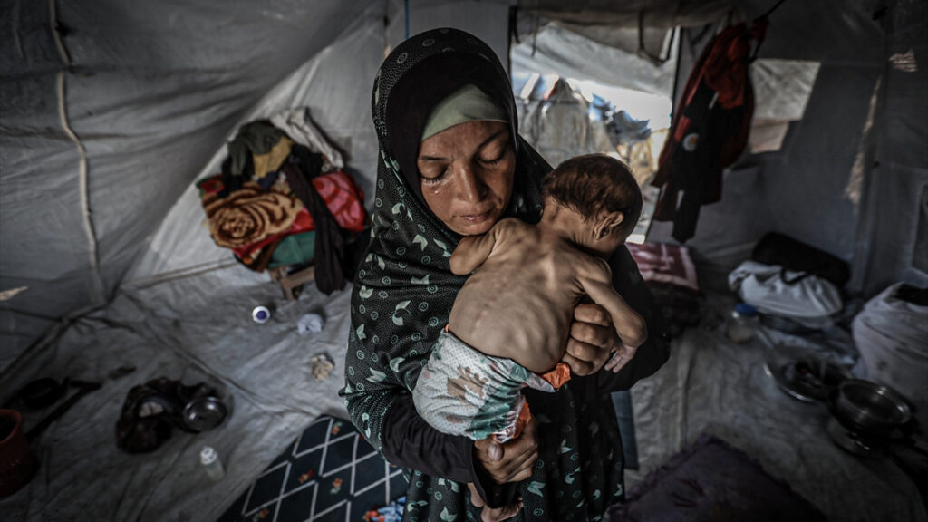 gazzede acliktan olenlerin sayisi artiyor pEavpNPI