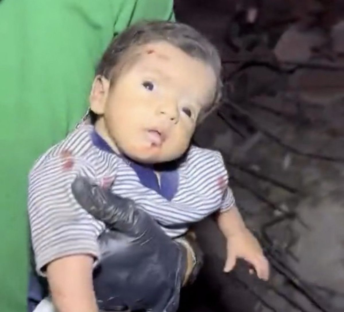 gazzede enkazdan cikarilan bebek sokun etkisiyle aglayamadi 1 cD5FLRsE
