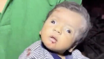 gazzede enkazdan cikarilan bebek sokun etkisiyle aglayamadi NsjLKXEB