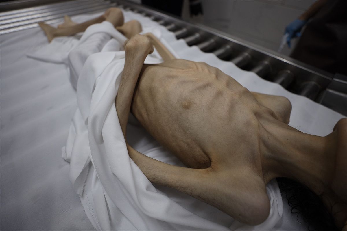 Gazze'de İsrail soykırımı: Filistinliler bombardıman ve açlıkla savaşıyor 1 gazzede israil soykirimi filistinliler bombardiman ve aclikla savasiyor 0 YyIqRc8a