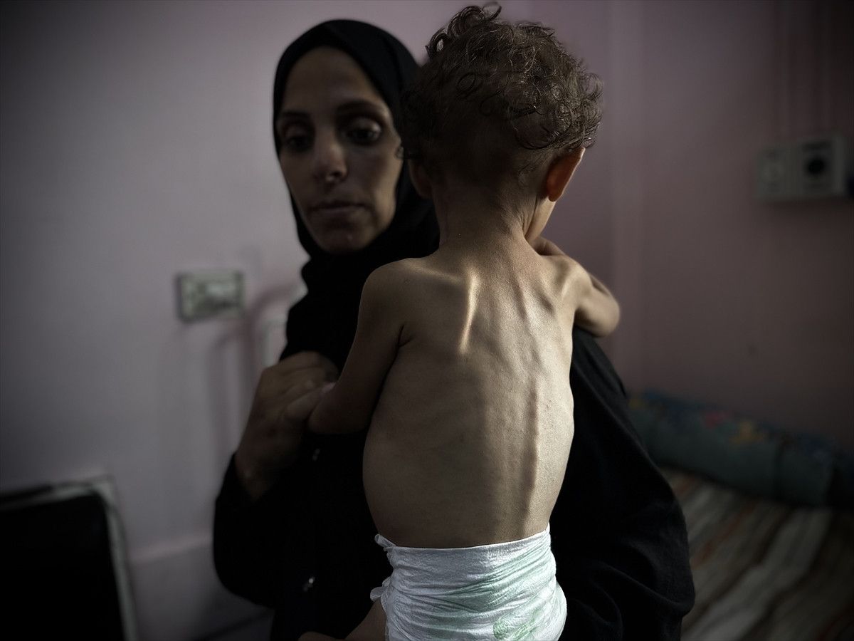 Gazze'de İsrail soykırımı: Filistinliler bombardıman ve açlıkla savaşıyor 13 gazzede israil soykirimi filistinliler bombardiman ve aclikla savasiyor 12 fb6DwJzs