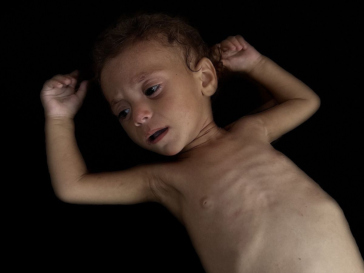 Gazze'de İsrail soykırımı: Filistinliler bombardıman ve açlıkla savaşıyor 14 gazzede israil soykirimi filistinliler bombardiman ve aclikla savasiyor 13 jOMfeE7i