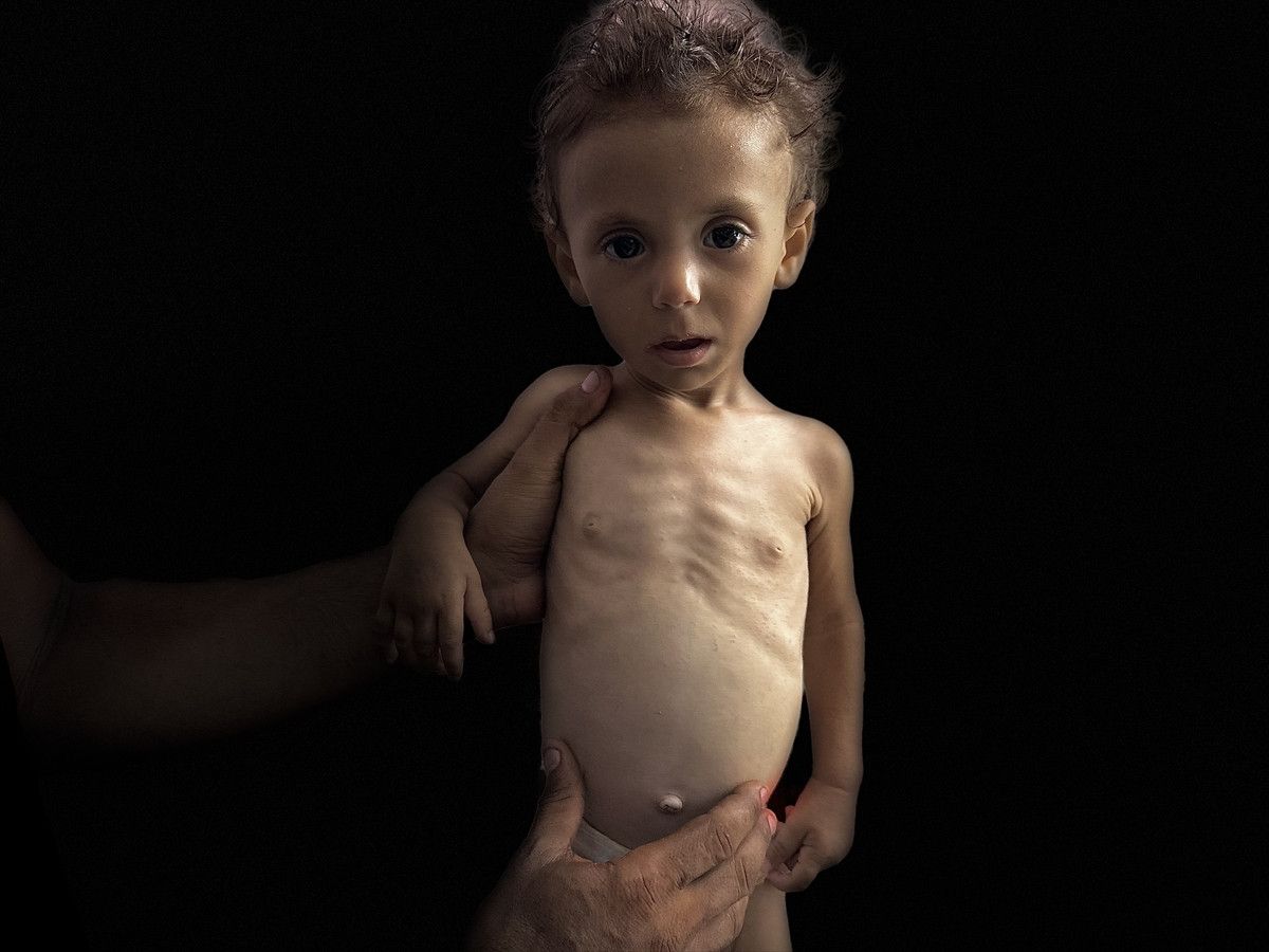 Gazze'de İsrail soykırımı: Filistinliler bombardıman ve açlıkla savaşıyor 15 gazzede israil soykirimi filistinliler bombardiman ve aclikla savasiyor 14