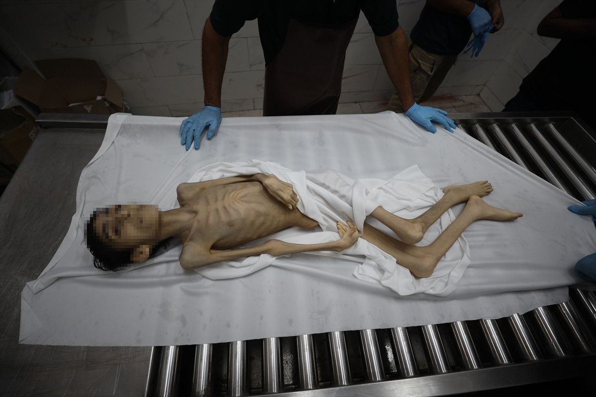 Gazze'de İsrail soykırımı: Filistinliler bombardıman ve açlıkla savaşıyor 9 gazzede israil soykirimi filistinliler bombardiman ve aclikla savasiyor 8 jWPYJvZa