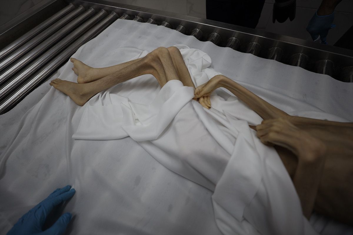 Gazze'de İsrail soykırımı: Filistinliler bombardıman ve açlıkla savaşıyor 10 gazzede israil soykirimi filistinliler bombardiman ve aclikla savasiyor 9 YEzUpv3G