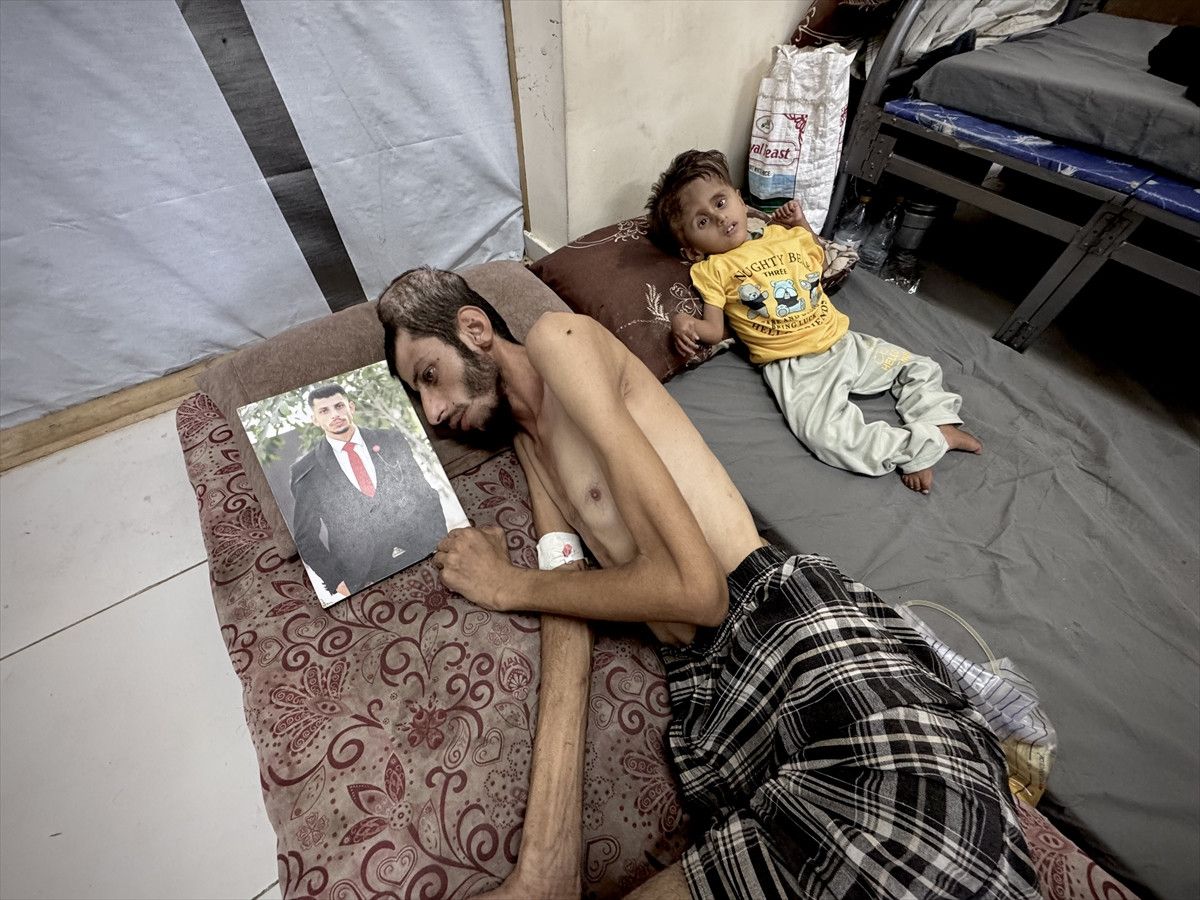 gazzede yardim arayisi yasam mucadelesine donustu israilin saldirisinda basindan vuruldu 2 qHgzqRqO