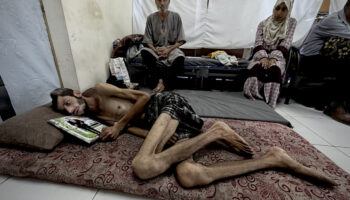 gazzede yardim arayisi yasam mucadelesine donustu israilin saldirisinda basindan vuruldu JSa1KGtf