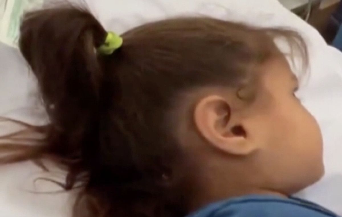 israil saldirilarinda kafasina mermi saplanan filistinli kiz cocugu hayata tutundu 1 ibzAlZ1p