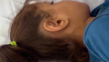 israil saldirilarinda kafasina mermi saplanan filistinli kiz cocugu hayata tutundu yHtJqXF1