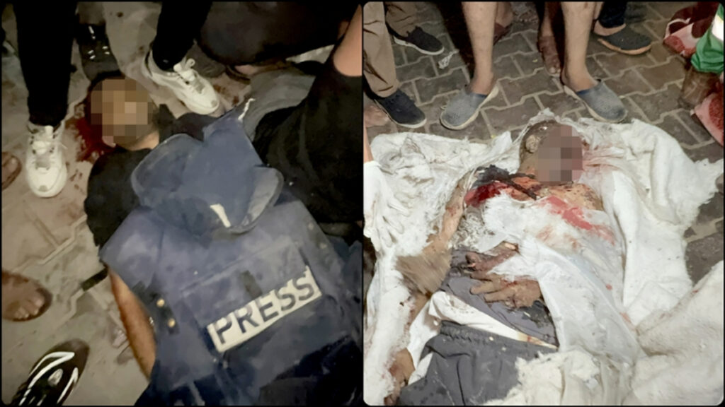 israilin gazetecilerin cadirina duzenledigi saldirida 5 gazeteci oldu zfUOR2Oq