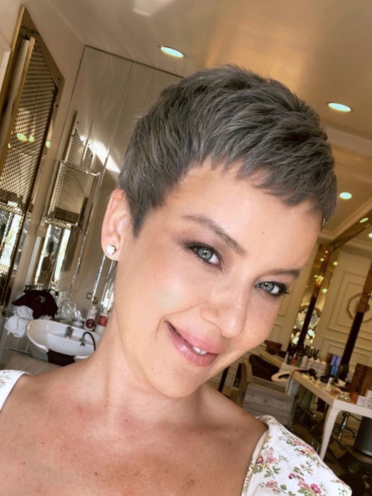 kanseri yenen nursel erginden yeni paylasim geldi son haline yorum yagdi 0 IrFwpQuu