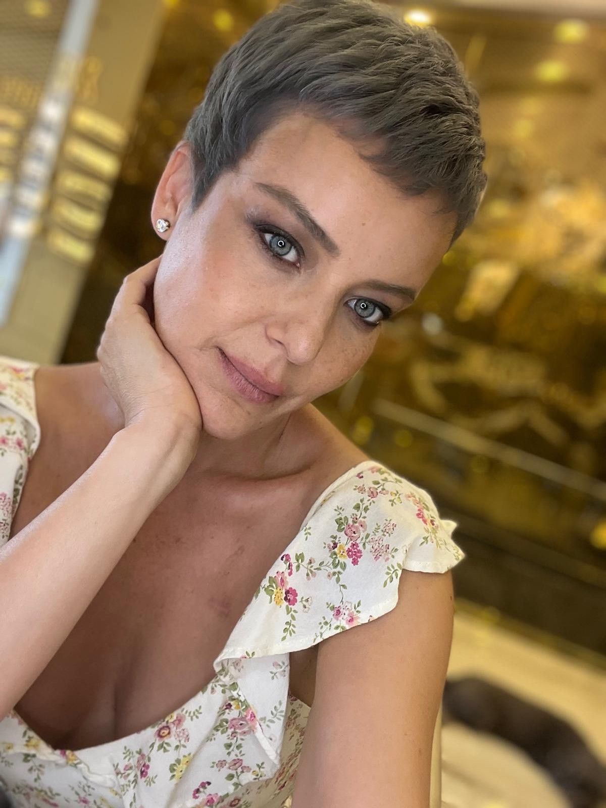 kanseri yenen nursel erginden yeni paylasim geldi son haline yorum yagdi 2 Vcz9yM6b