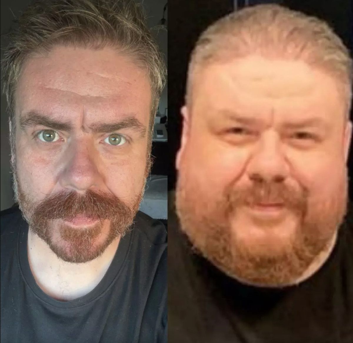 komedyen emre mutlunun son hali sasirtti 133 kilo verdi 1