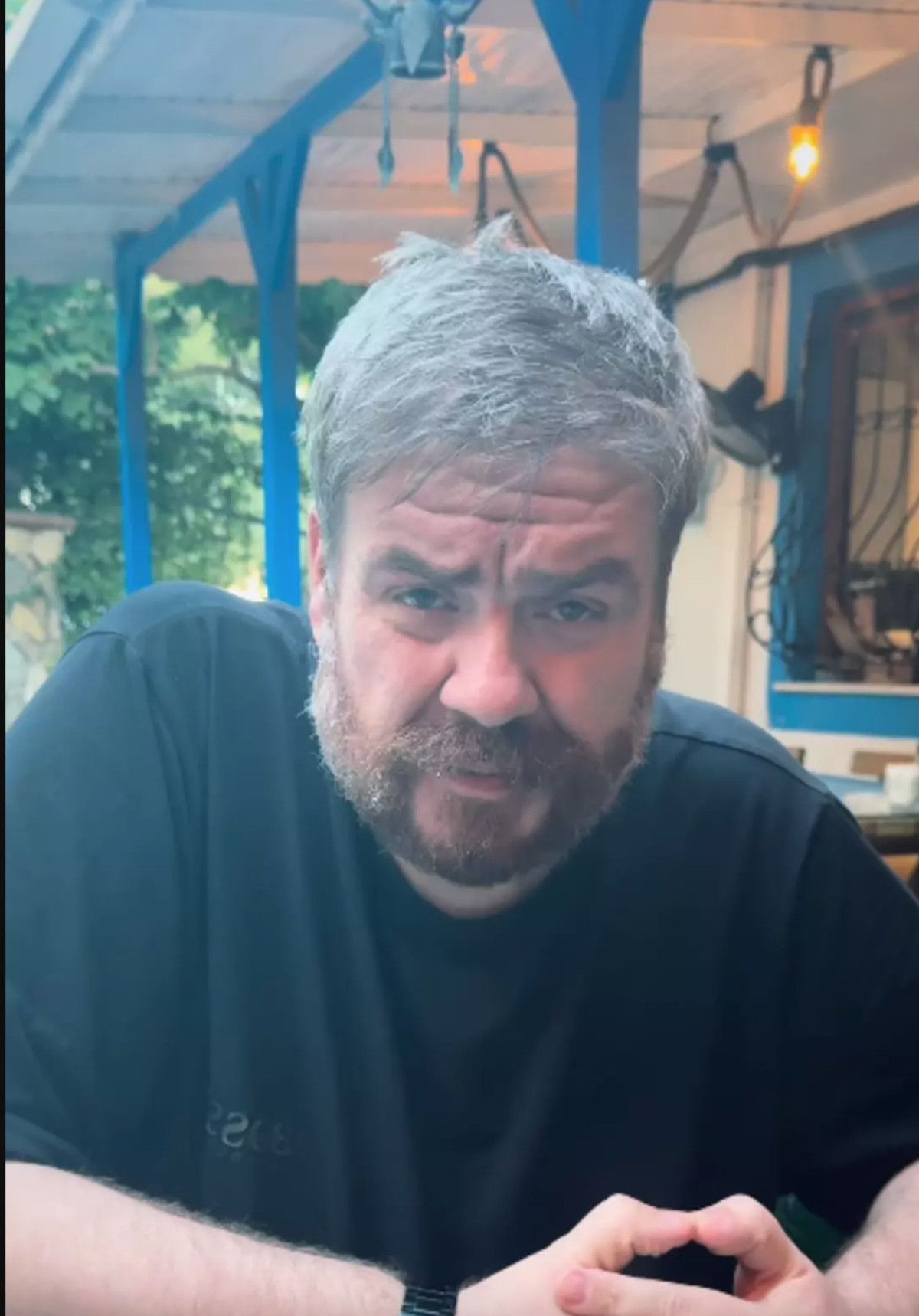 komedyen emre mutlunun son hali sasirtti 133 kilo verdi 2 UHQzCTIQ