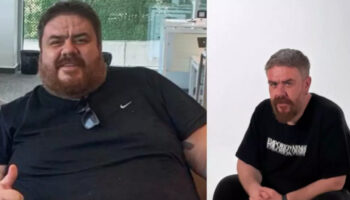 komedyen emre mutlunun son hali sasirtti 133 kilo verdi RvNXrUQj