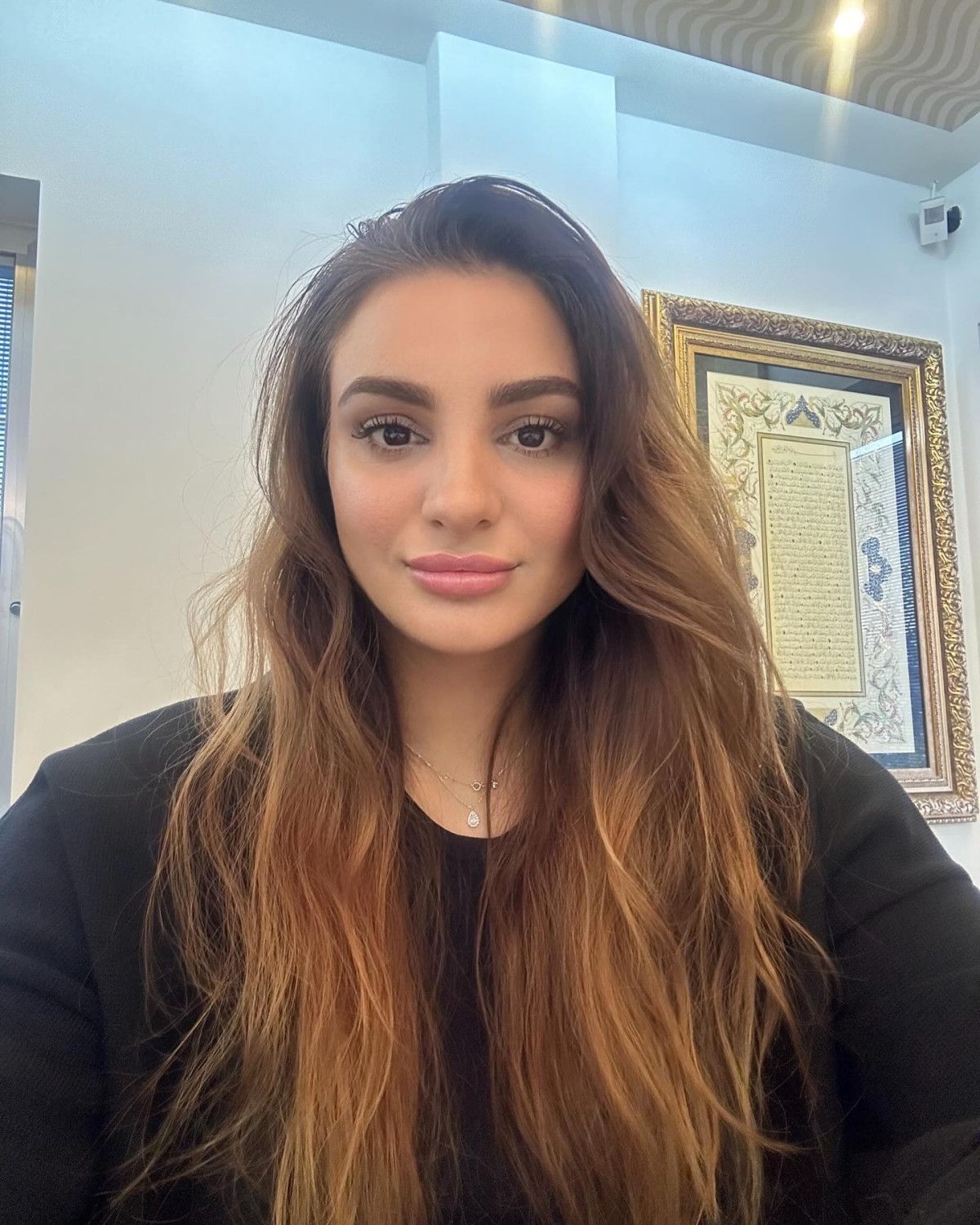 popstar ozlemin son hali sasirtti basortusunu cikarip estetik yaptirdi 2 2V8eIjRw