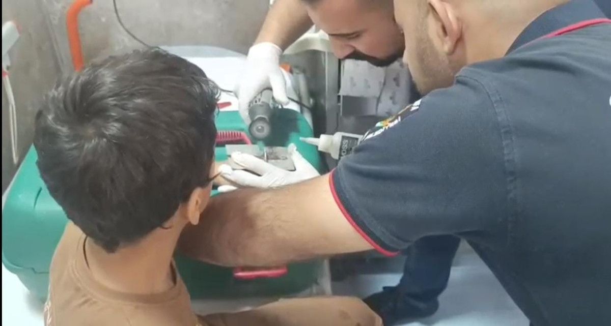 sanliurfada cocugun parmagina sikistirdigi civata pulu kesilerek cikartildi 1