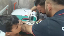 sanliurfada cocugun parmagina sikistirdigi civata pulu kesilerek cikartildi W1fCqyk9