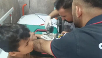 sanliurfada cocugun parmagina sikistirdigi civata pulu kesilerek cikartildi W1fCqyk9