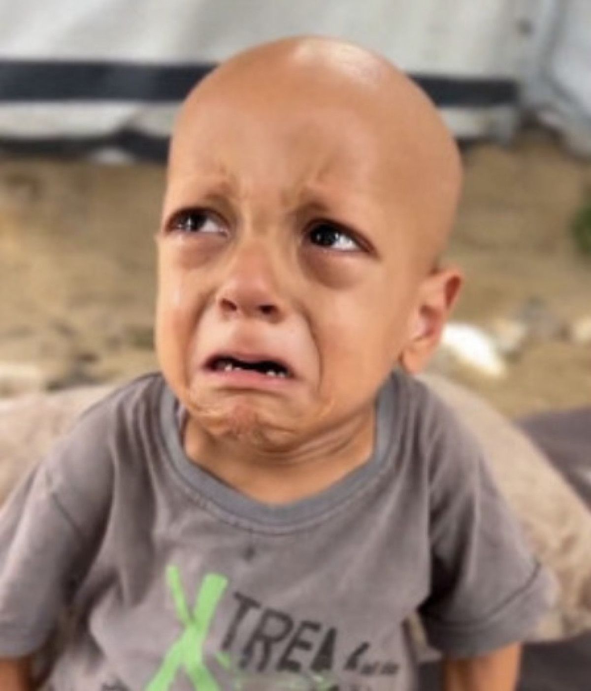 turkiyede hayatini kaybetti gazzeli abdullahin kardesinin tedavisi suruyor 2 2Q6zsJwL