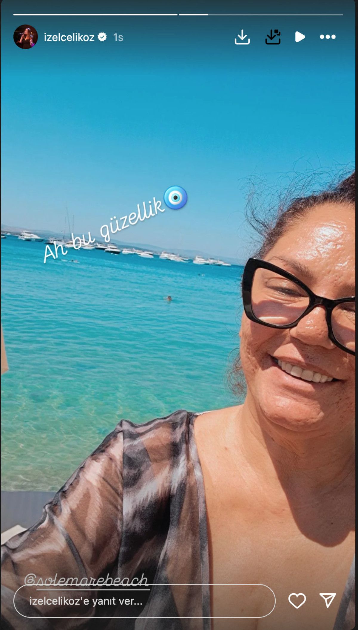 unlu sarkici izel photoshopsuz fotograf yayinladi selulitler gercektir 0 D9XNjHaK