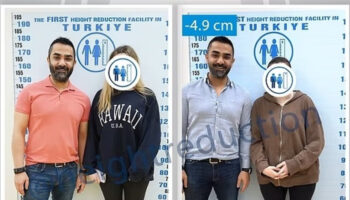 yabancilardan bir garip trend boy kisaltma icin turkiyeye geliyorlar ERrHwM6b