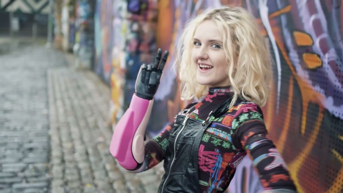 19 yasindaki fenomenin sasirtan biyonik kollari 1 v8gctI73