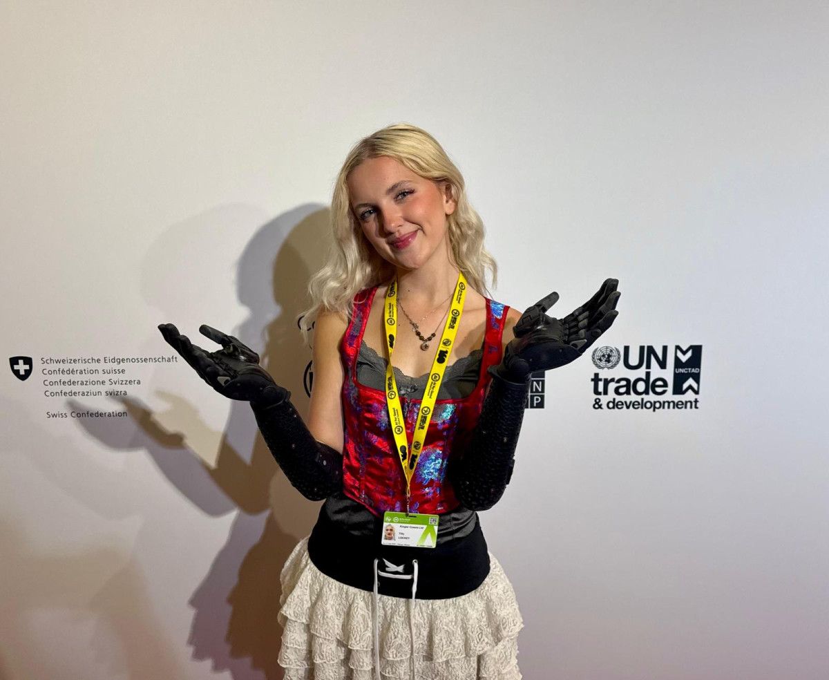 19 yasindaki fenomenin sasirtan biyonik kollari 2 gsV6BTTT