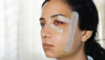 adanada eski esini dovup serbest kalan supheli tutuklandi B9yObhwt