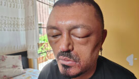 adanada saclarini siyahlastirmak isteyen adamin basina gelmeyen kalmadi 5pTdayAl