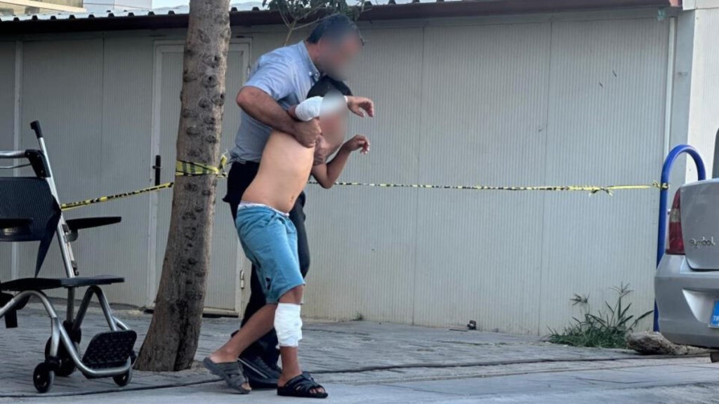 adiyamanda basibos kopek cocuga saldirdi NHauAuPN