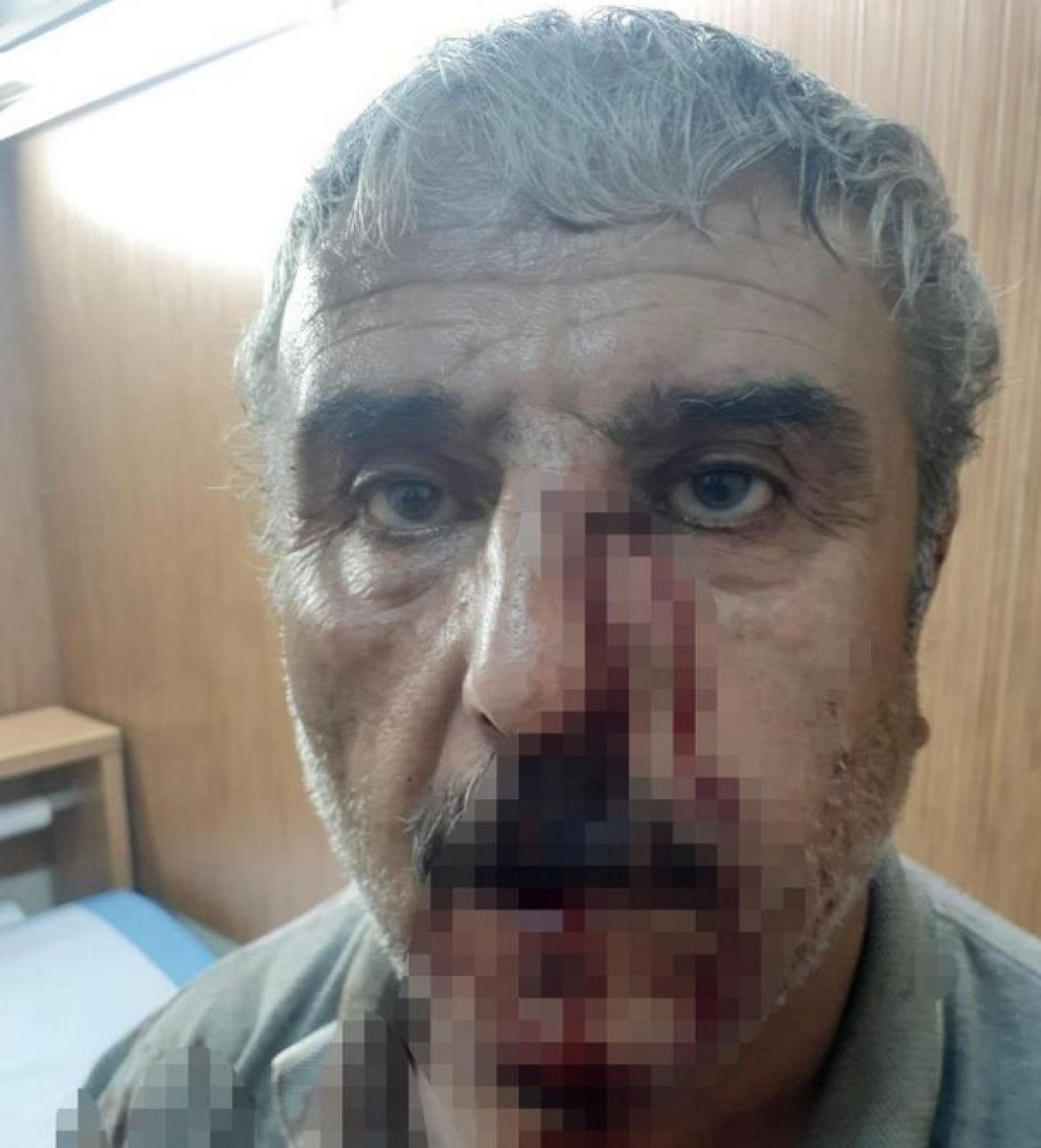 denizlide emekli ogretmen ile doktorun mesai kavgasi 1 ji6d1Hbr