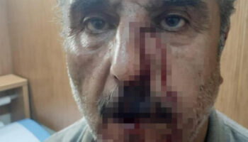 denizlide emekli ogretmen ile doktorun mesai kavgasi ZEO6MRty